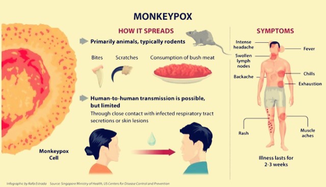 CDC證實亞城一旅客感染了猴痘，死亡率高達10%，無疫苗！